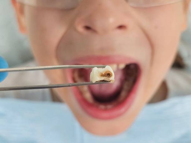Best Emergency Pediatric Dental Care in Hanover, MN